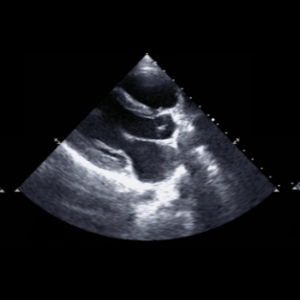 Set of patterns from heart echocardiography.