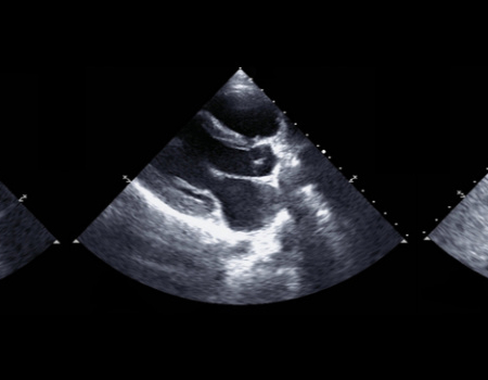Set of patterns from heart echocardiography.