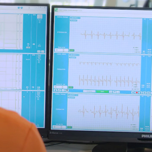 Monitors showing cardiac rehab data.