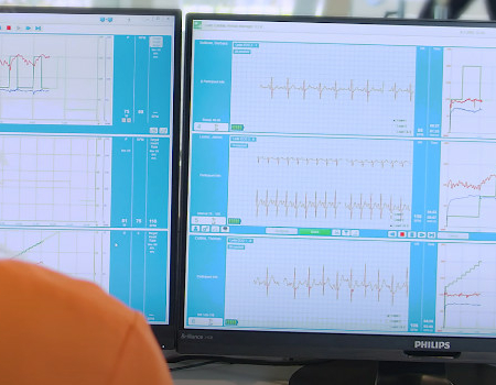 Monitors showing cardiac rehab data.